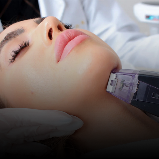 12 days of Christmas 50% OFF Morpheus8 + Nanolaser Peel Treatment - One Session
