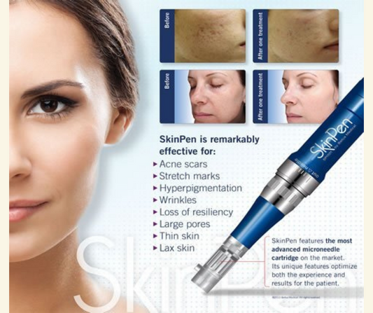 12 days of Christmas 25% OFF MICRONEEDLING + BBL PHOTOFACIAL
