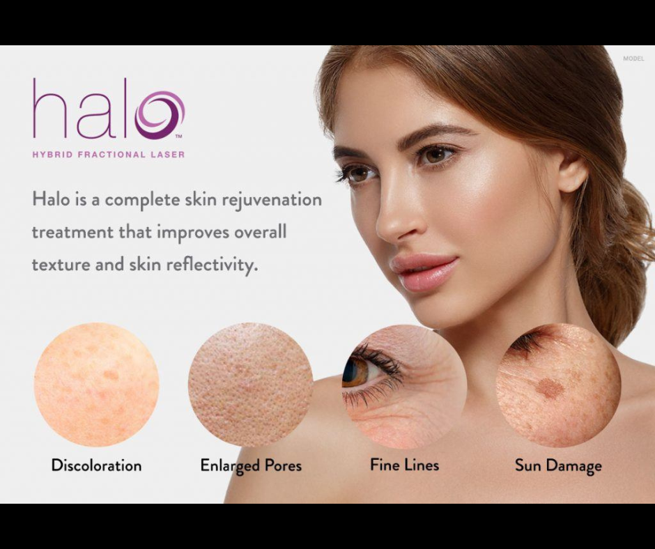 $475 off Halo Laser Treatments