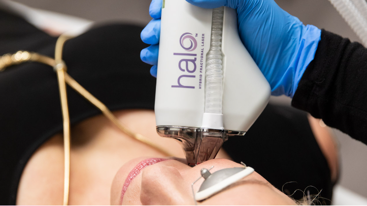 20% Off all Halo Skin Resurfacing