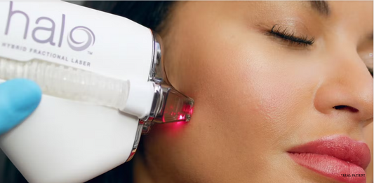 20% Off all Halo Skin Resurfacing