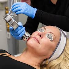 Sculptra + Laser Combo treatment with Exosomes!
