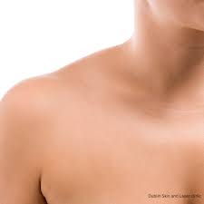 20% Off all Halo Skin Resurfacing